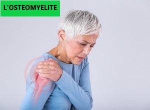Remède bio pour soigner l’ostéomyélite