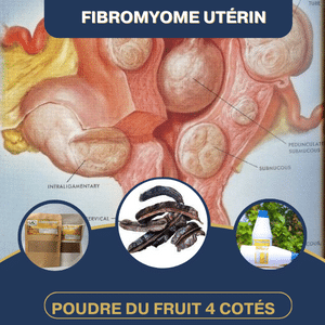 Guérison De Fibromyome Utérin Par Fruit 4 Cotés
