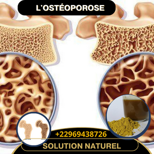Solution Naturelle Contre l'Ostéoporose