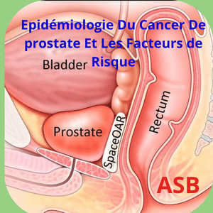 Epidémiologie Du Cancer De prostate Et Les Facteurs de Risque